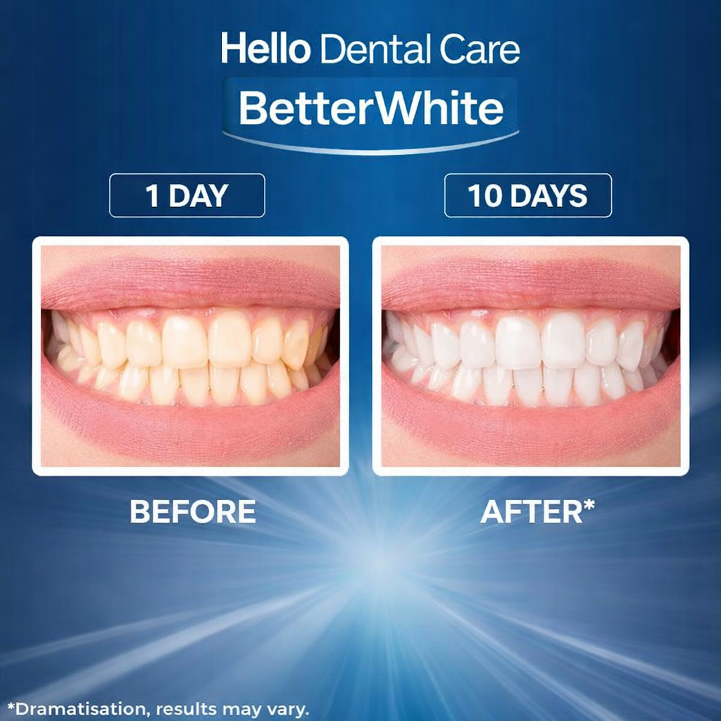 Hello Teeth Whitening Powder (UK Dentist Approved🏆)